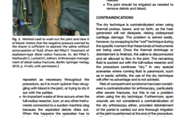 article dry arthroscopy