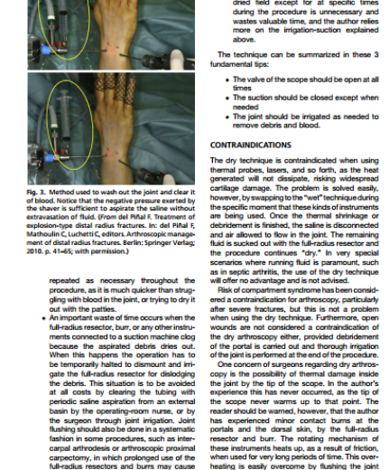article dry arthroscopy