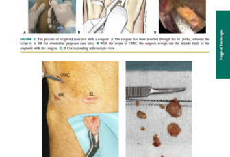2012 Dry Arthroscopic CA