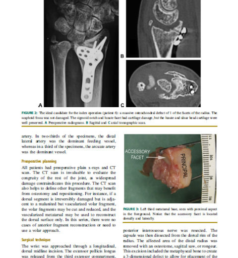 Vascularized graft