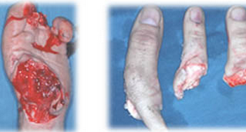 situacion-preoperatoria