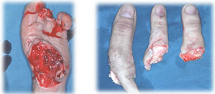 situacion-preoperatoria