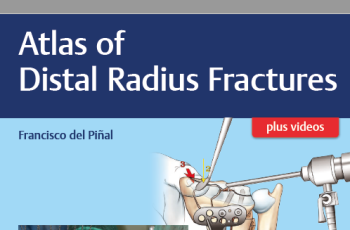 Atlas of distal radius fractures_lanzamiento_01_01_20180606