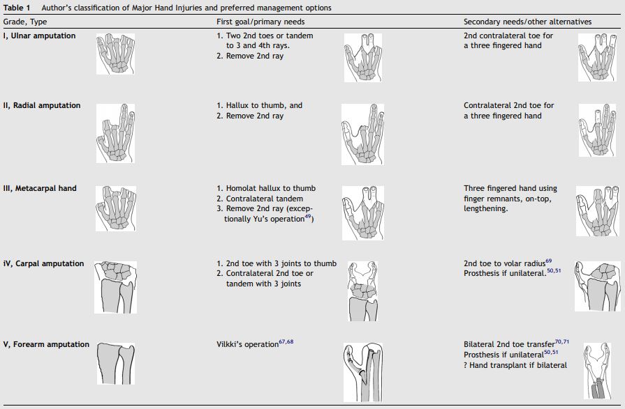 Major hand injuries classification by Dr Piñal